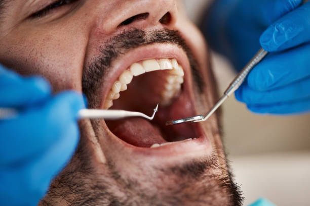 Best Emergency Dental Care for Sports Injuries in Lawson, MO